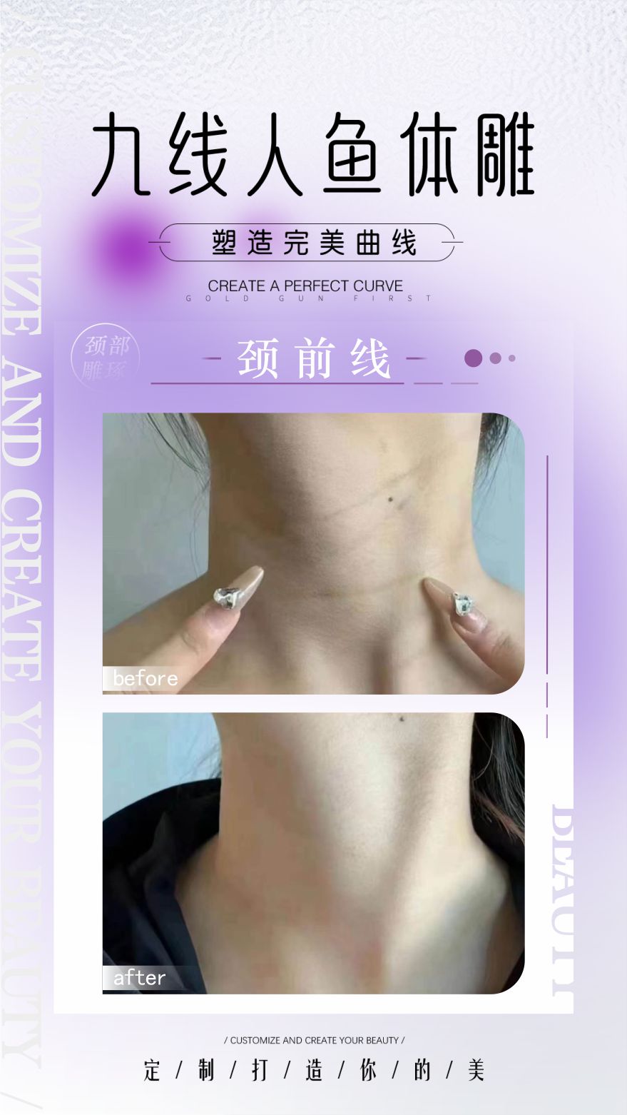 九线人鱼体雕案例