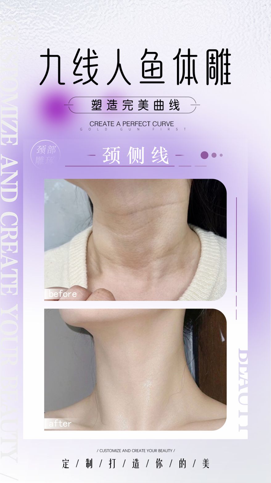 九线人鱼体雕案例